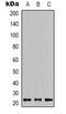 KRAS Proto-Oncogene, GTPase antibody, GTX34386, GeneTex, Western Blot image 