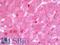 Alpha-1-antitrypsin antibody, LS-B10260, Lifespan Biosciences, Immunohistochemistry paraffin image 