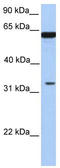 Post-GPI Attachment To Proteins 3 antibody, TA342058, Origene, Western Blot image 