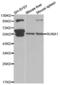 RUNX Family Transcription Factor 1 antibody, abx001672, Abbexa, Western Blot image 