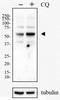Sequestosome 1 antibody, NBP1-42821, Novus Biologicals, Western Blot image 