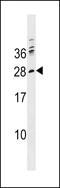 Pre T Cell Antigen Receptor Alpha antibody, 60-241, ProSci, Western Blot image 