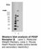 Platelet Derived Growth Factor Receptor Beta antibody, LS-B3667, Lifespan Biosciences, Western Blot image 