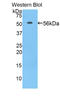 Acidic Nuclear Phosphoprotein 32 Family Member A antibody, LS-C292601, Lifespan Biosciences, Western Blot image 