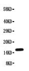 Midkine antibody, PA1530, Boster Biological Technology, Western Blot image 