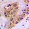 Casein Kinase 1 Alpha 1 antibody, LS-C358959, Lifespan Biosciences, Immunohistochemistry paraffin image 