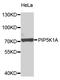 Phosphatidylinositol-4-Phosphate 5-Kinase Type 1 Alpha antibody, A7941, ABclonal Technology, Western Blot image 