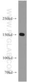 DExH-Box Helicase 29 antibody, 13923-1-AP, Proteintech Group, Western Blot image 