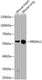 PR/SET Domain 11 antibody, GTX64967, GeneTex, Western Blot image 