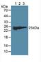 Glutathione S-transferase Mu 2 antibody, LS-C294264, Lifespan Biosciences, Western Blot image 