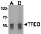Transcription factor EB antibody, TA319741, Origene, Western Blot image 