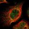 Ataxin 1 antibody, NBP1-90065, Novus Biologicals, Immunocytochemistry image 