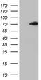 Thyroid Hormone Receptor Alpha antibody, TA805259, Origene, Western Blot image 