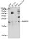 Retinoic Acid Receptor Responder 2 antibody, GTX32518, GeneTex, Western Blot image 