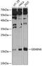 Gem Nuclear Organelle Associated Protein 6 antibody, 14-384, ProSci, Western Blot image 