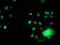 Glutathione S-Transferase Theta 2 (Gene/Pseudogene) antibody, NBP2-03126, Novus Biologicals, Immunocytochemistry image 