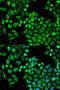 4-aminobutyrate aminotransferase, mitochondrial antibody, A07133, Boster Biological Technology, Western Blot image 