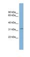 Transmembrane protein 163 antibody, orb325531, Biorbyt, Western Blot image 