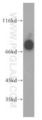 Interleukin 3 Receptor Subunit Alpha antibody, 13655-1-AP, Proteintech Group, Western Blot image 