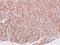 Vascular Endothelial Growth Factor D antibody, PA5-27276, Invitrogen Antibodies, Immunohistochemistry frozen image 