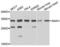 Snail Family Transcriptional Repressor 1 antibody, LS-C334126, Lifespan Biosciences, Western Blot image 