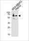 Beta-Transducin Repeat Containing E3 Ubiquitin Protein Ligase antibody, PA5-35278, Invitrogen Antibodies, Western Blot image 