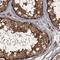 Nucleoporin GLE1 antibody, NBP2-47450, Novus Biologicals, Immunohistochemistry paraffin image 