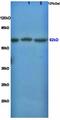 Rho Associated Coiled-Coil Containing Protein Kinase 1 antibody, orb100140, Biorbyt, Western Blot image 