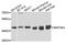 Mitogen-Activated Protein Kinase Kinase 4 antibody, A14781, ABclonal Technology, Western Blot image 