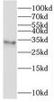Transmembrane Protein 38A antibody, FNab08780, FineTest, Western Blot image 