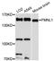 Formin Like 1 antibody, LS-C748072, Lifespan Biosciences, Western Blot image 