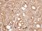 Calcineurin subunit B type 1 antibody, GTX109127, GeneTex, Immunohistochemistry paraffin image 