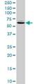 NME/NM23 Family Member 8 antibody, H00051314-D01P, Novus Biologicals, Western Blot image 