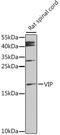 Vasoactive Intestinal Peptide antibody, 14-487, ProSci, Western Blot image 