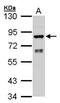 Cytochrome P450 Oxidoreductase antibody, GTX101100, GeneTex, Western Blot image 