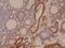 Interferon Regulatory Factor 4 antibody, NBP2-77422, Novus Biologicals, Immunohistochemistry frozen image 