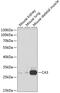 Carbonic Anhydrase 3 antibody, GTX53907, GeneTex, Western Blot image 