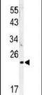 MOB Kinase Activator 1A antibody, PA5-14268, Invitrogen Antibodies, Western Blot image 