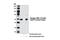 Non-receptor tyrosine-protein kinase TNK1 antibody, 5638S, Cell Signaling Technology, Western Blot image 