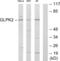 Glycerol kinase 2 antibody, abx013604, Abbexa, Western Blot image 
