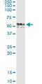 Cobalamin Binding Intrinsic Factor antibody, H00002694-M03, Novus Biologicals, Western Blot image 