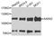 Alanyl-TRNA Synthetase 2, Mitochondrial antibody, A7826, ABclonal Technology, Western Blot image 