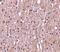 TNF Superfamily Member 12 antibody, PA5-20211, Invitrogen Antibodies, Immunohistochemistry frozen image 