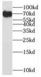 Pre-mRNA-splicing factor SLU7 antibody, FNab07990, FineTest, Western Blot image 