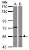 Ankyrin Repeat And SOCS Box Containing 3 antibody, GTX117802, GeneTex, Western Blot image 