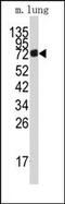 Adenosine Monophosphate Deaminase 3 antibody, AP14716PU-N, Origene, Western Blot image 