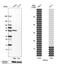 TNF Receptor Associated Factor 4 antibody, PA5-62595, Invitrogen Antibodies, Western Blot image 