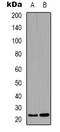 Breast Carcinoma Amplified Sequence 4 antibody, LS-C368887, Lifespan Biosciences, Western Blot image 