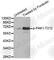 P21 (RAC1) Activated Kinase 1 antibody, AP0186, ABclonal Technology, Western Blot image 