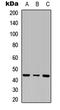Inhibin Subunit Beta B antibody, LS-C356126, Lifespan Biosciences, Western Blot image 